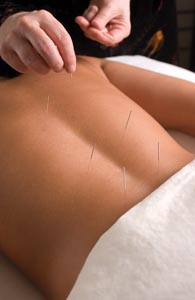 10march_acupuncture